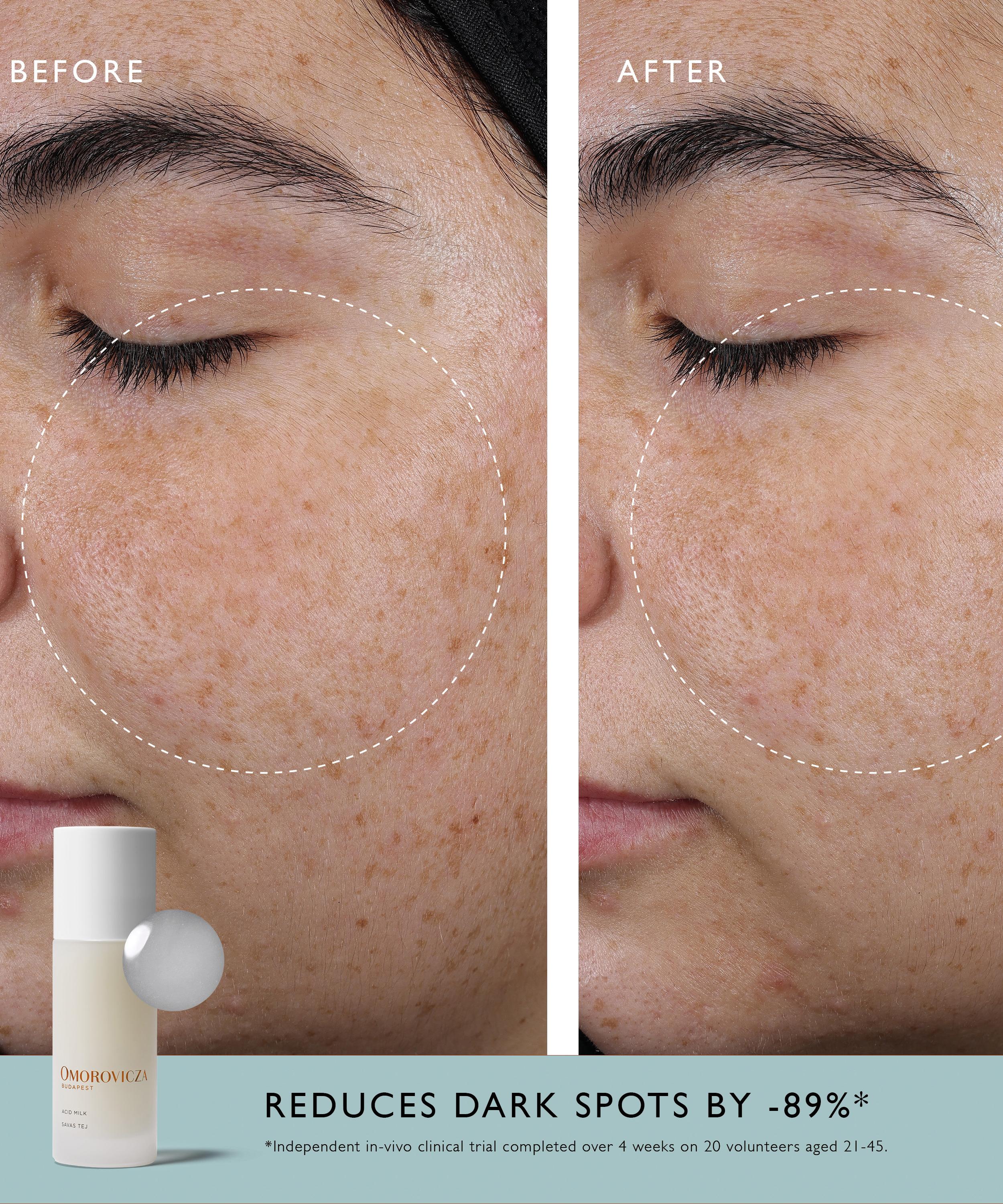 Omorovicza - Acid Milk 100ml image number 1