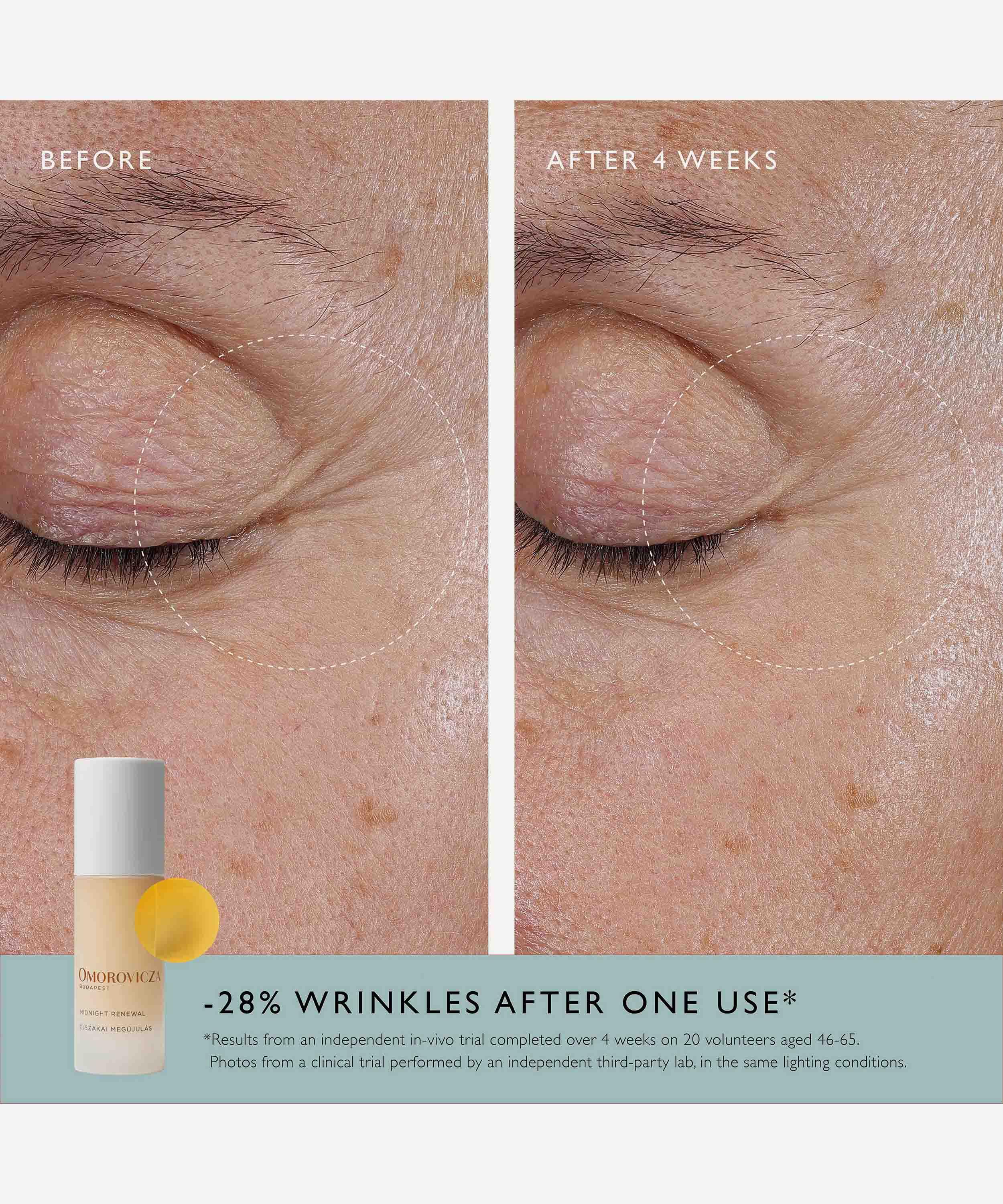 Omorovicza - Midnight Renewal 30ml image number 9