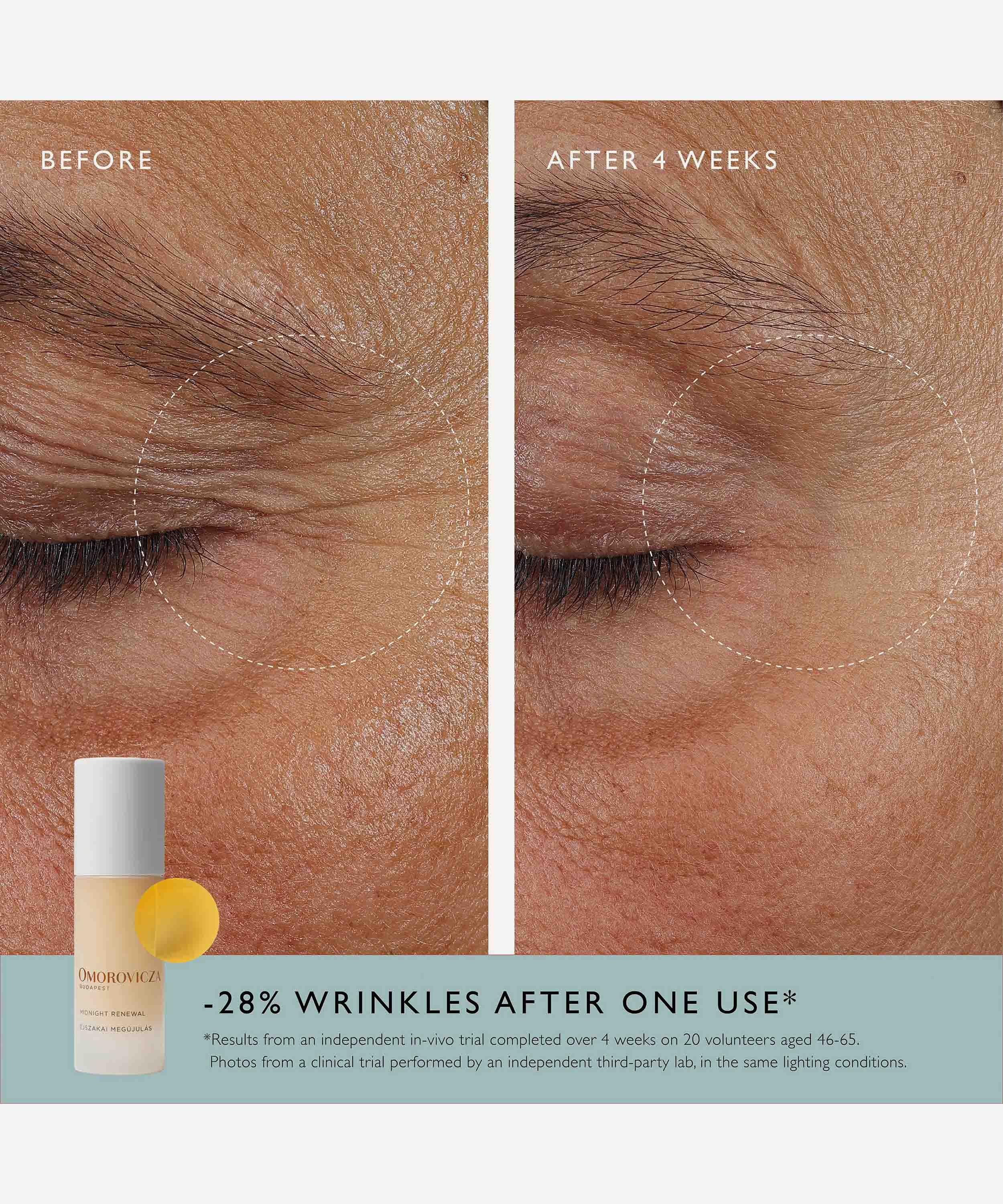 Omorovicza - Midnight Renewal 30ml image number 10