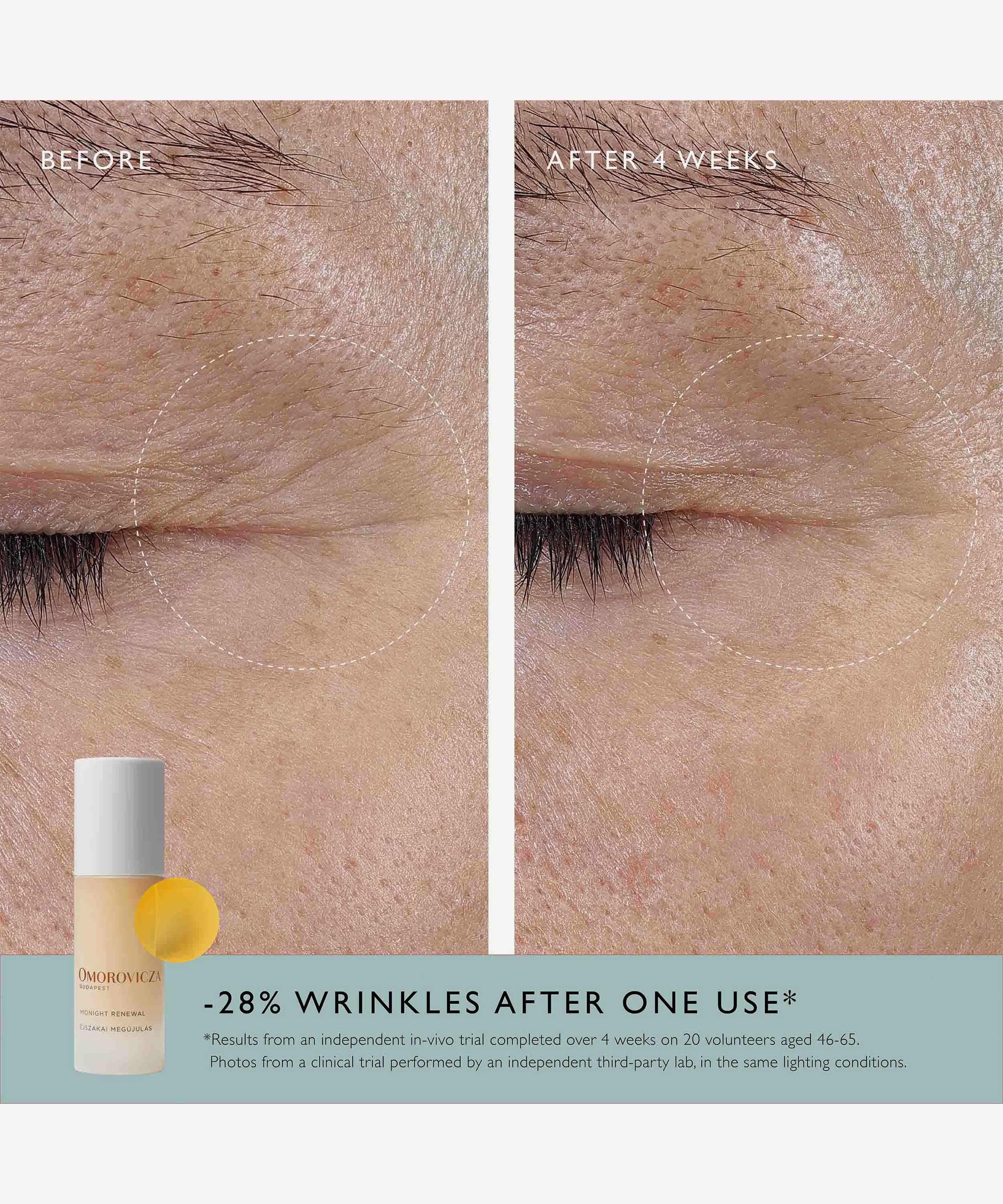 Omorovicza - Midnight Renewal 30ml image number 11