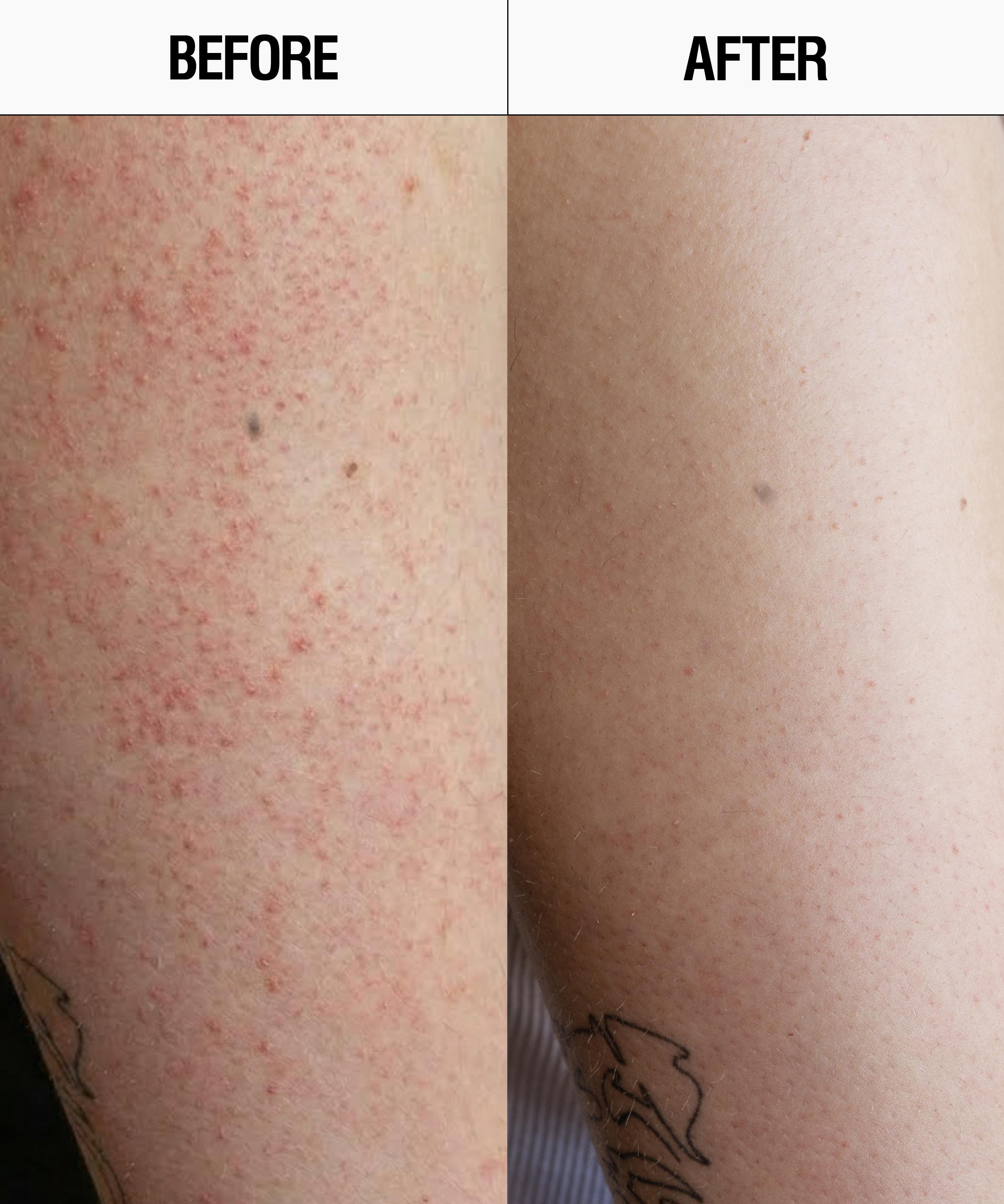 Grown Alchemist - Resurfacing Targeted Body Lotion 300ml image number 5