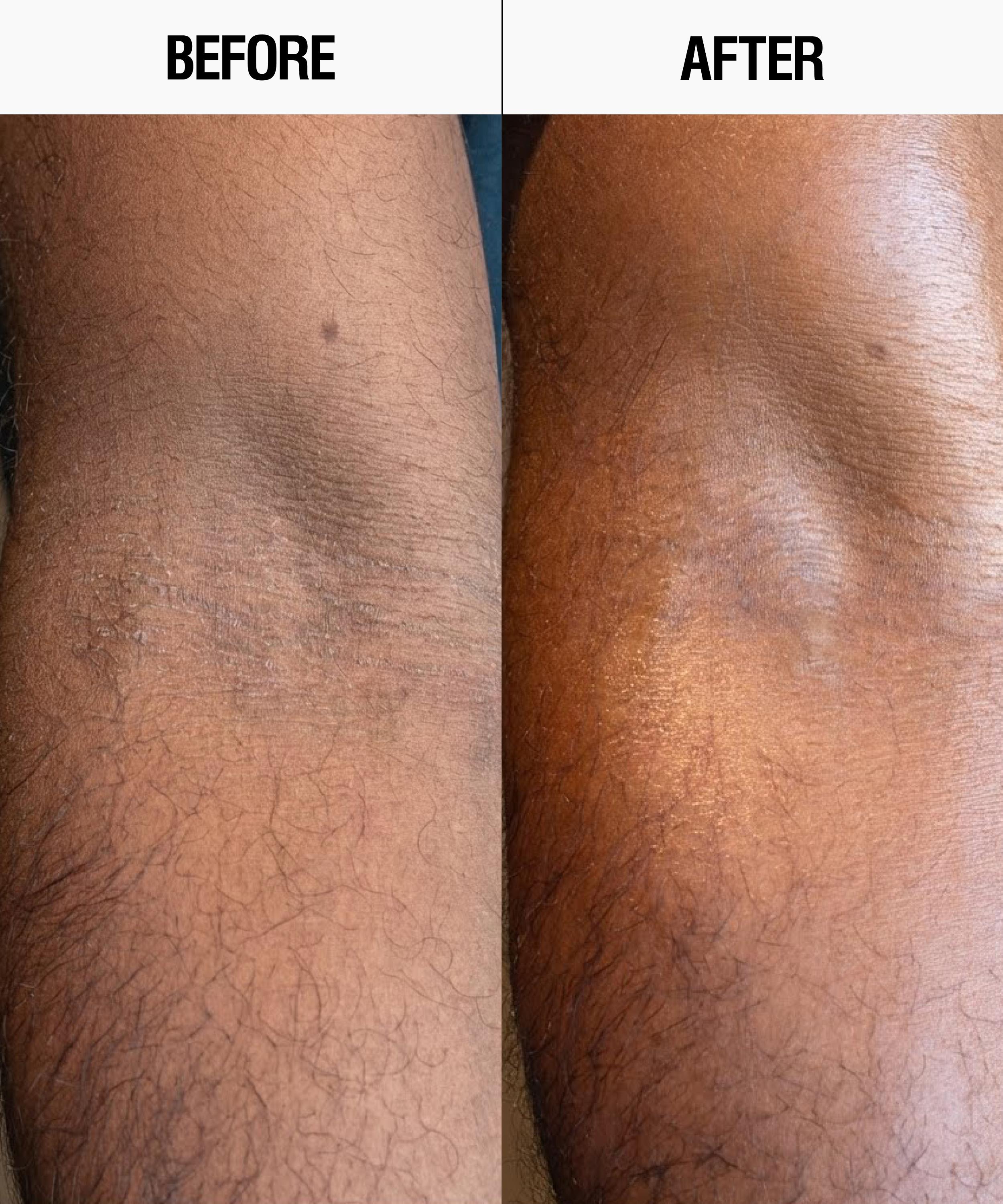 Grown Alchemist - Resurfacing Targeted Body Cleanser 300ml image number 5