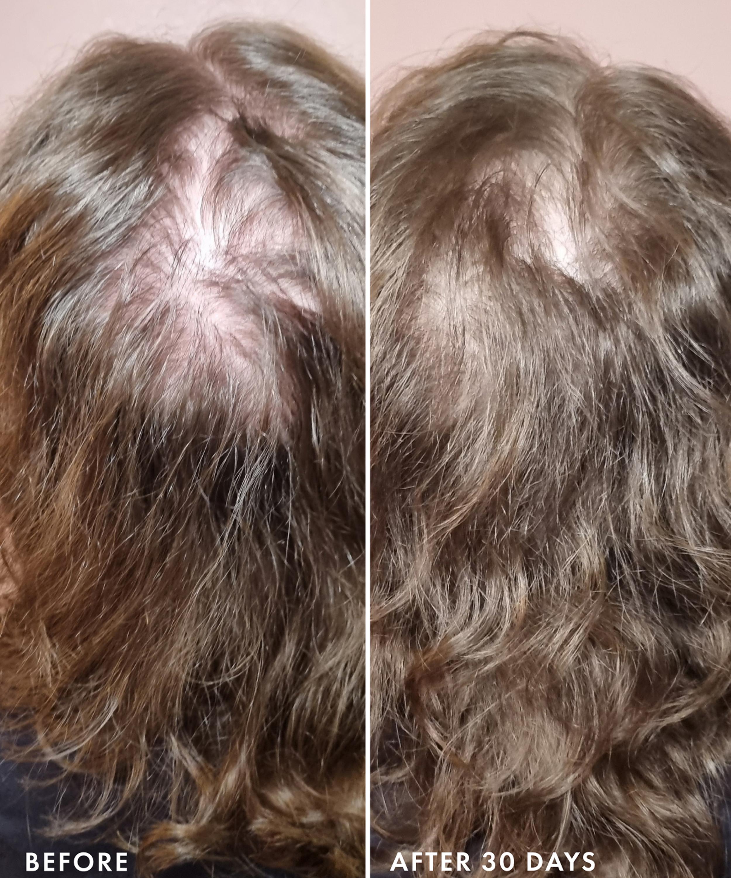 Beauty Pie - Renewed Density Anti-Hair-Loss Treatment 100ml image number 2