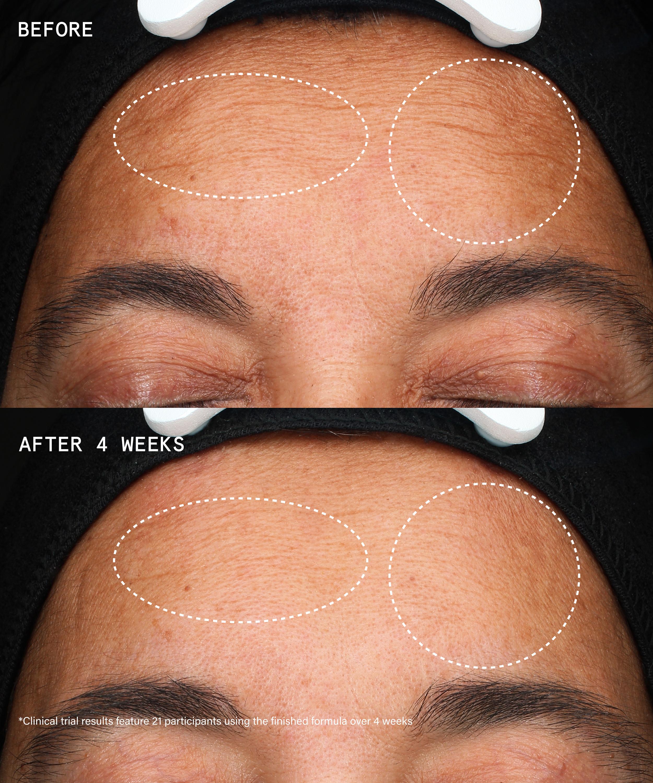 Beauty Pie - Youthbomb Extreme Retinal Triple Renewal Serum 30ml image number 4