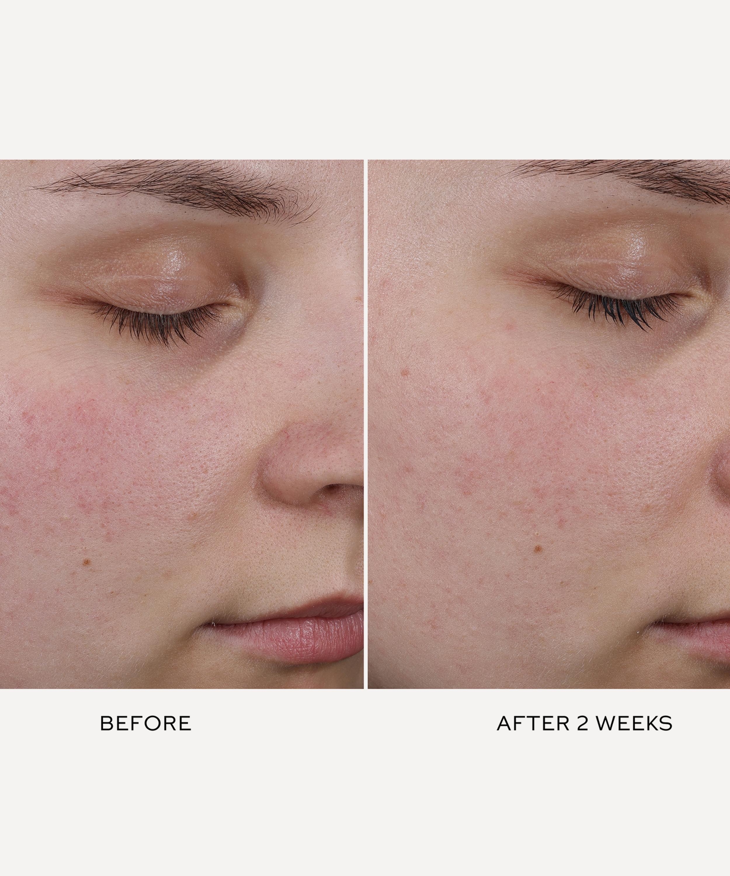 Westman Atelier - Pore Refining Complex 15ml image number 1