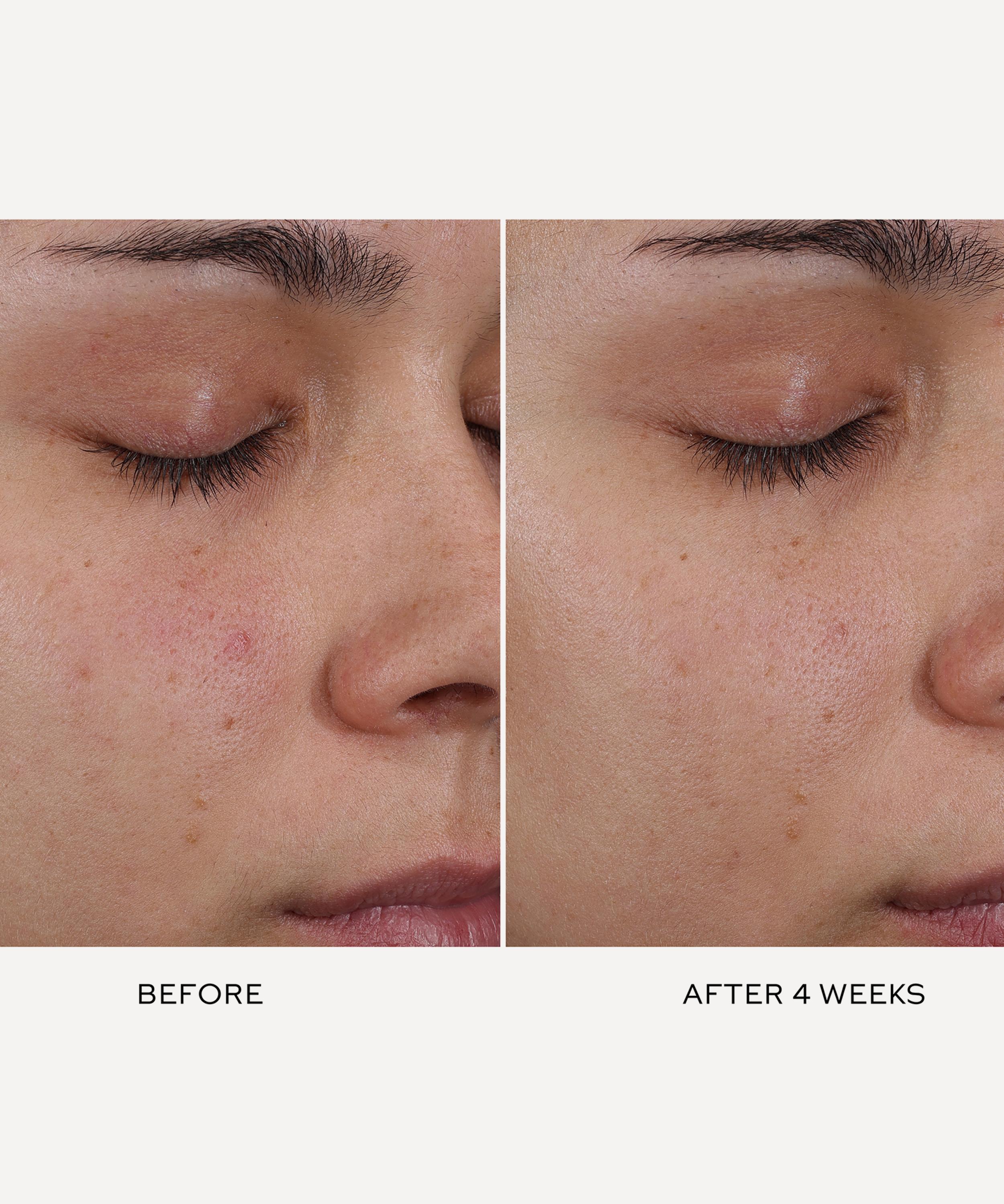 Westman Atelier - Pore Refining Complex 15ml image number 3