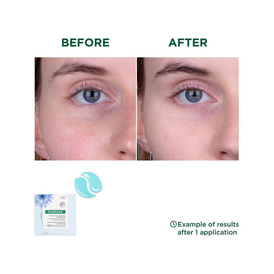 KLORANE Bleuet BIO Pads apaisants pour les yeux 