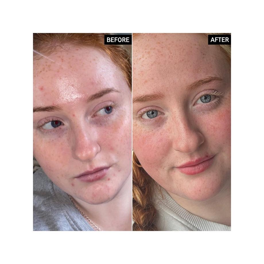 THE INKEY LIST  Moisturiser Vitamin B, C And E  