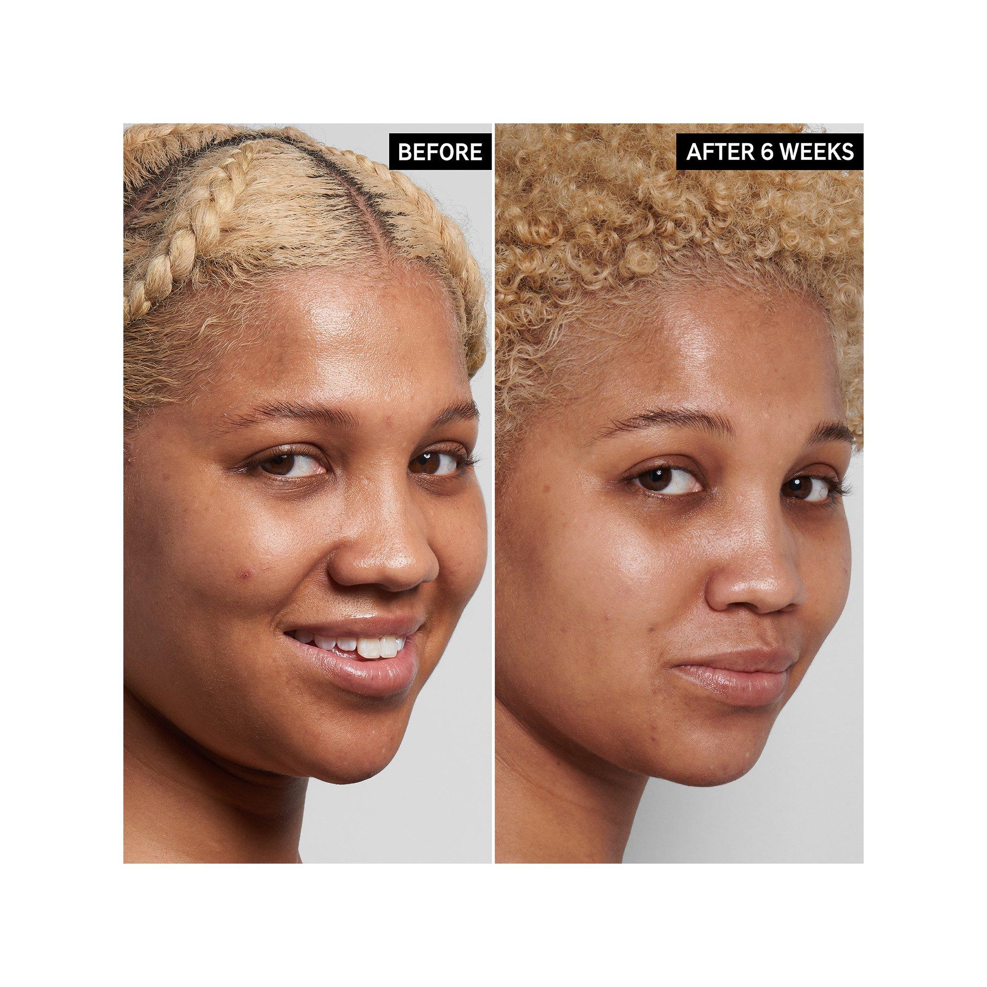 THE INKEY LIST  Niacinamide Oil Control Serum 