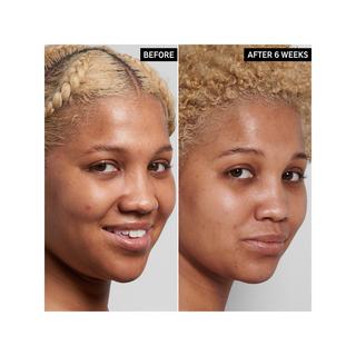 THE INKEY LIST  Niacinamide Oil Control Serum 