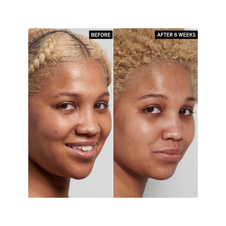 THE INKEY LIST  Niacinamide Oil Control Serum 