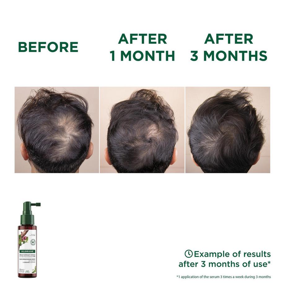 KLORANE  Quinine et edelweiss BIO Sérum contre la chute des cheveux 