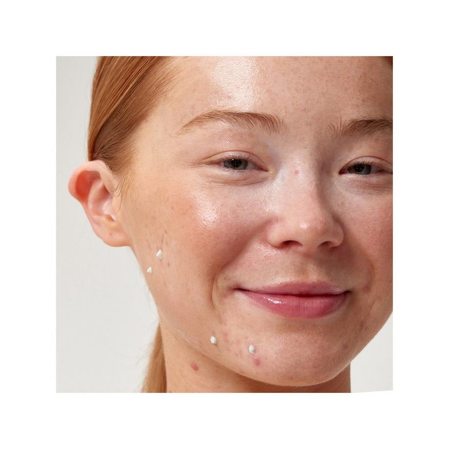 THE INKEY LIST  Bernsteinsäure Pflege gegen Pickel 