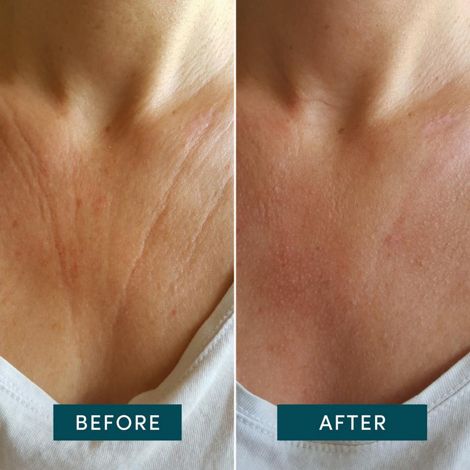 APRICOT  Wiederverwendbares Dekolleté Pad mit Hyaluron 