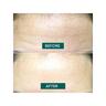 APRICOT Front Pad - fantastic forehead  