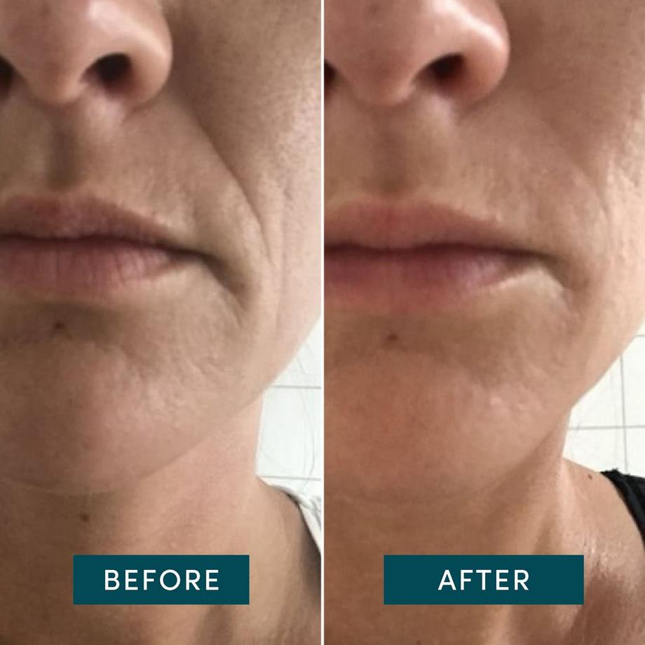 APRICOT  Wiederverwendbare Mund Pads mit Hyaluron 