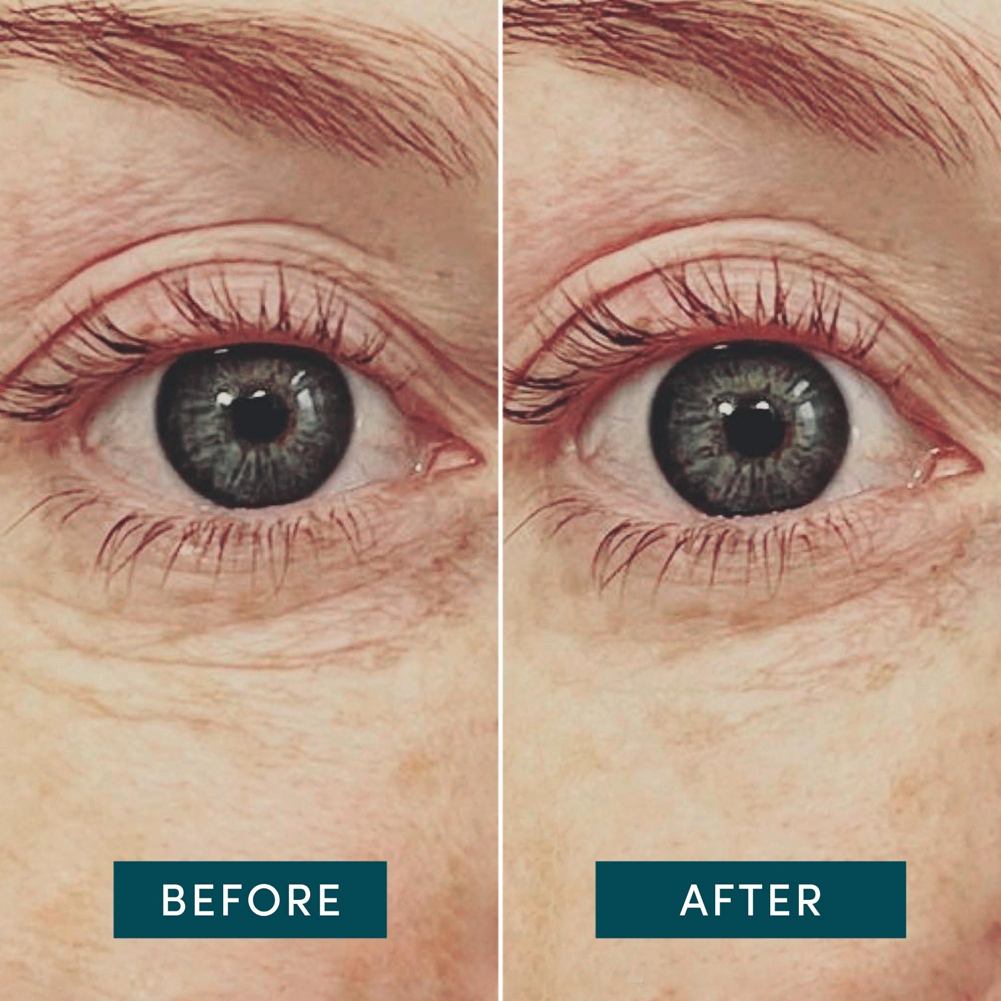 APRICOT  Pads Yeux Réutilisables à l’Acide Hyaluronique 