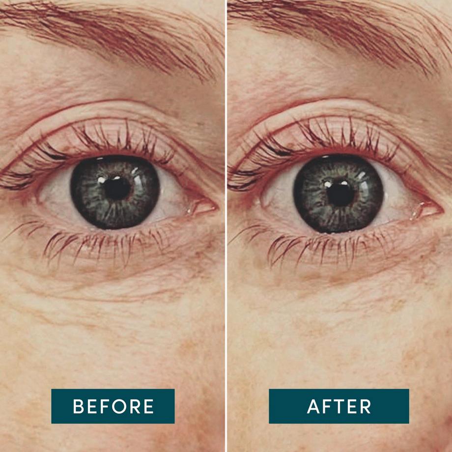 APRICOT  Wiederverwendbare Augen Pads mit Hyaluron 