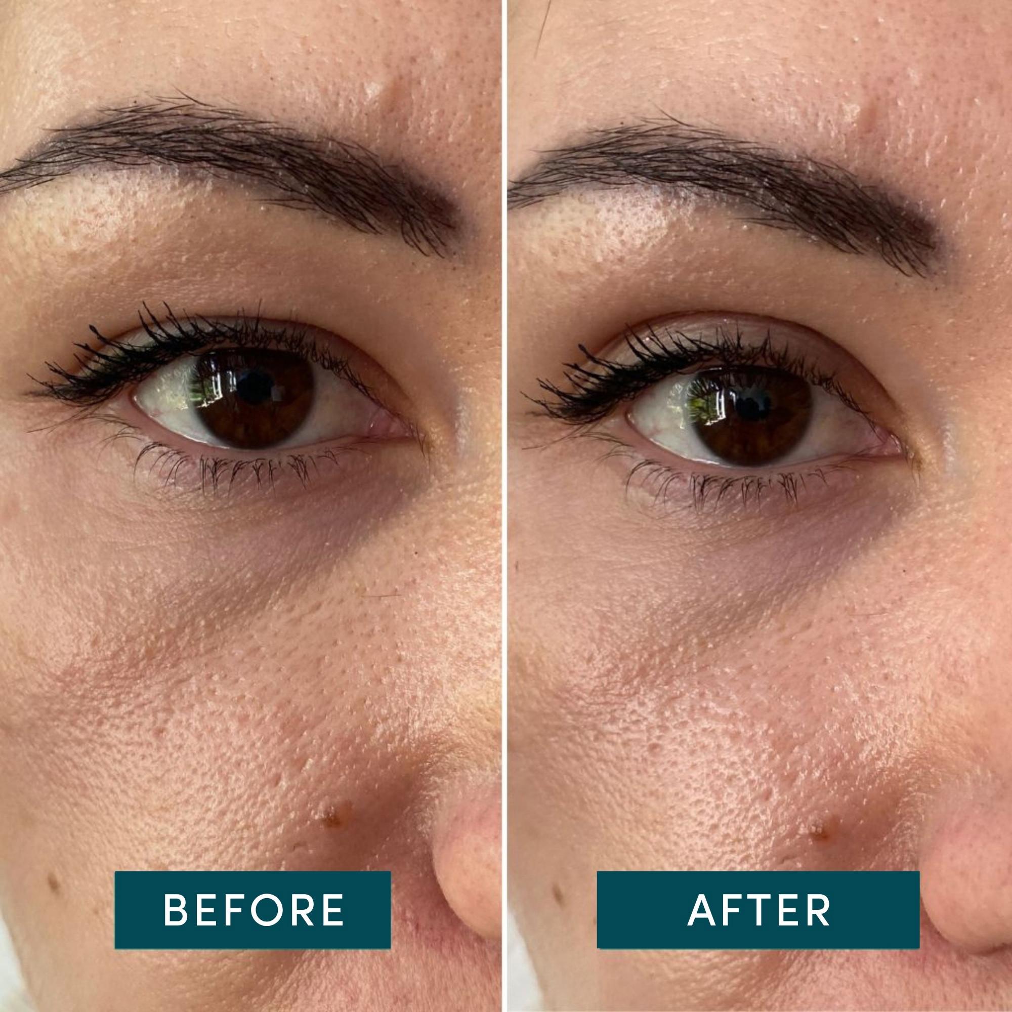 APRICOT  Schlupflider Tapes 