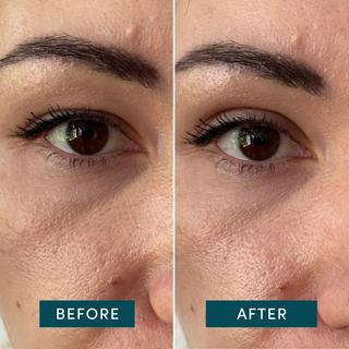 APRICOT  Schlupflider Tapes 