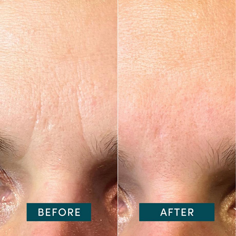 APRICOT  Gesicht Patches mit Hyaluron 