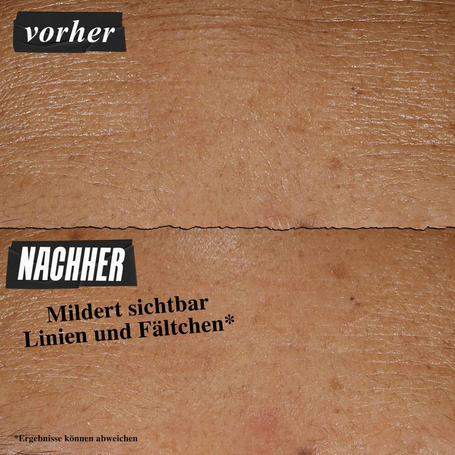 Kiehl's Retinol Retinol Skin-Renewing Daily Micro-Dose Serum 