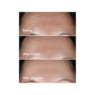 CLINIQUE Smart Clinical Repair Serum 