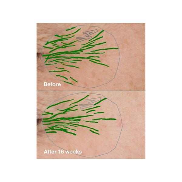 CLINIQUE Smart Clinical Repair Serum 