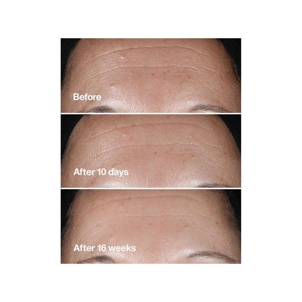 CLINIQUE Smart Clinical Repair Serum 