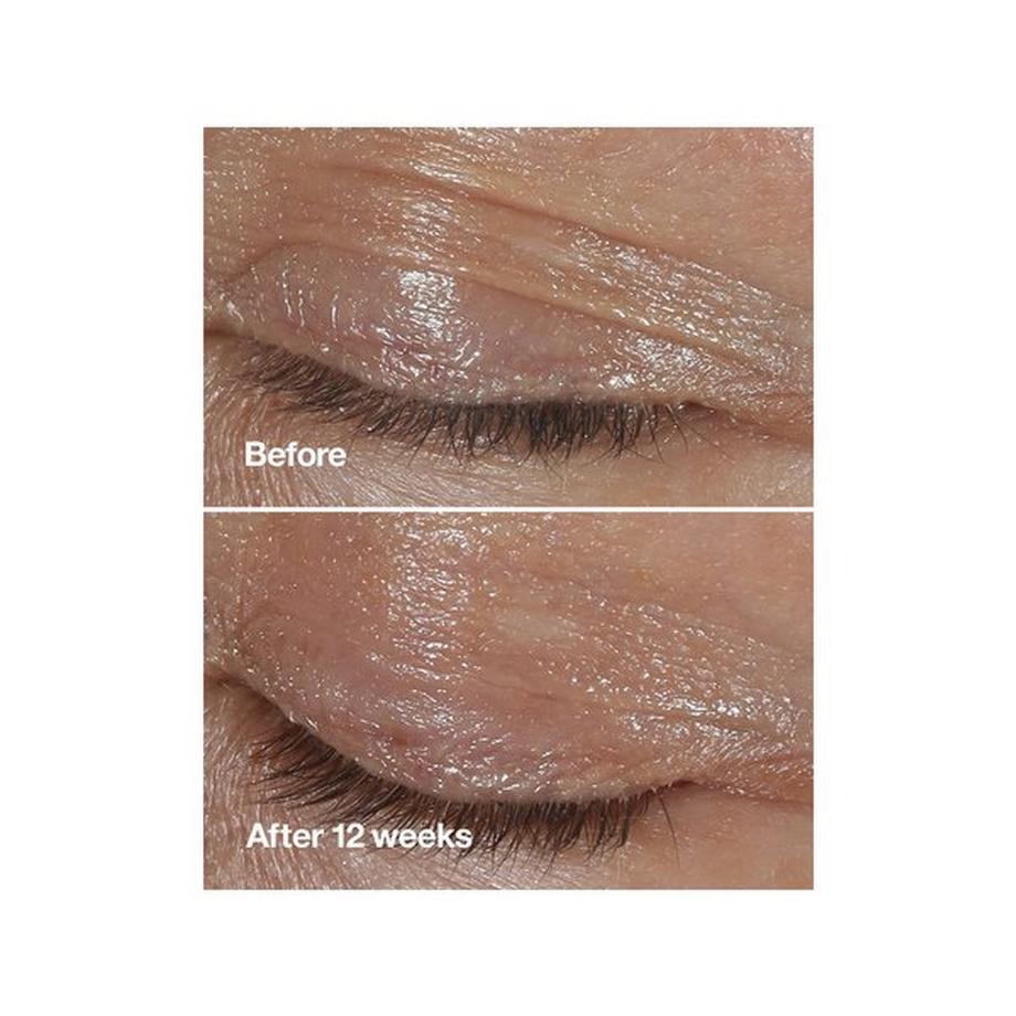 CLINIQUE  Smart Clinical Repair™ Wrinkle Repair Eye Cream 