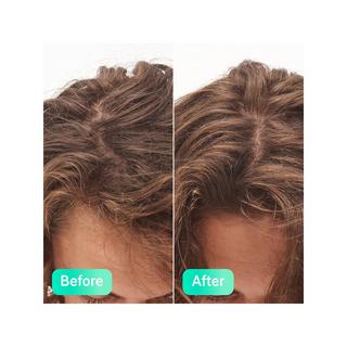 THE INKEY LIST GLYCOLIC ACID Glycolic Acid Exfol Scalp Scrub  