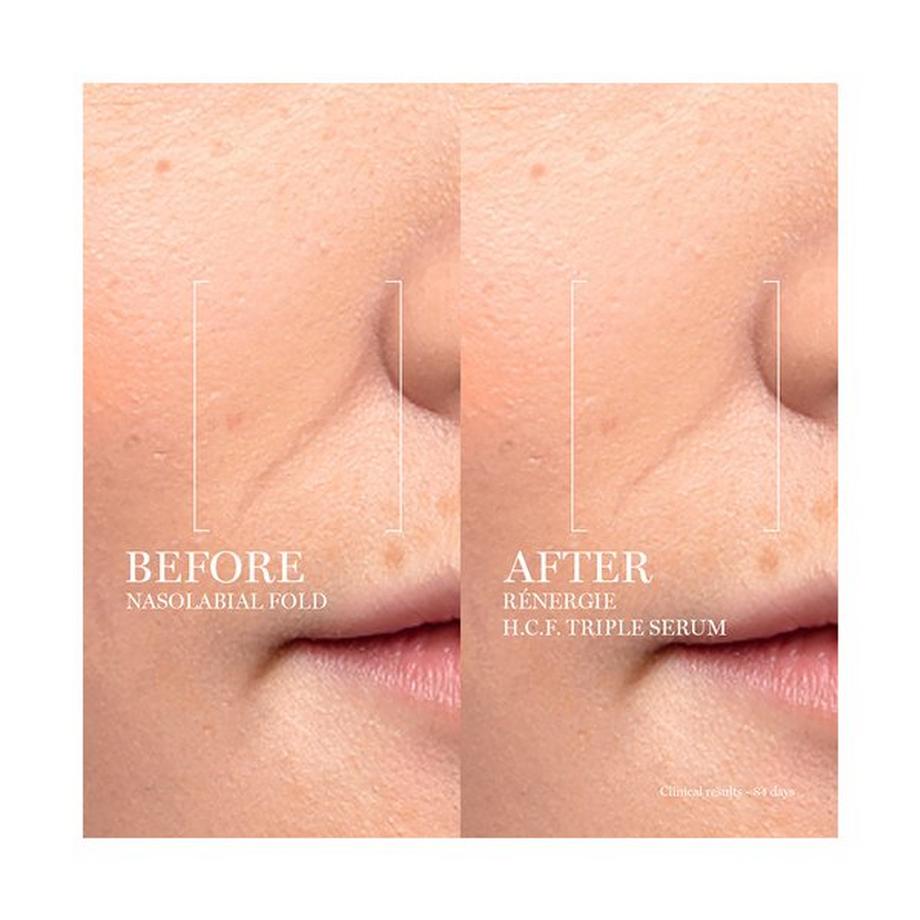 Lancôme Rénergie Multi-Lift Ultra Triple Serum 