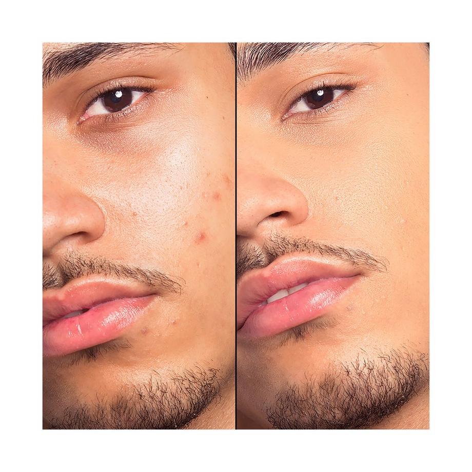   HD SKIN FOUNDATION-2 