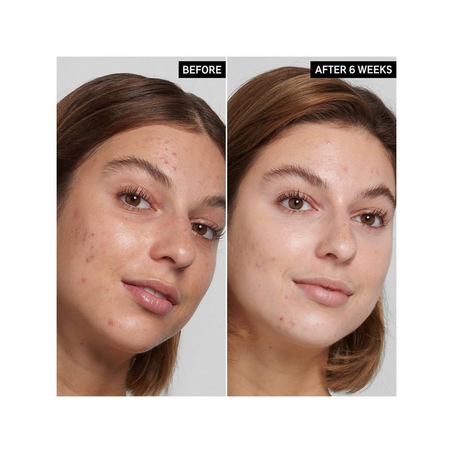 THE INKEY LIST  Detergente Viso - Detergente per pori e brufoli all'acido salicilico 