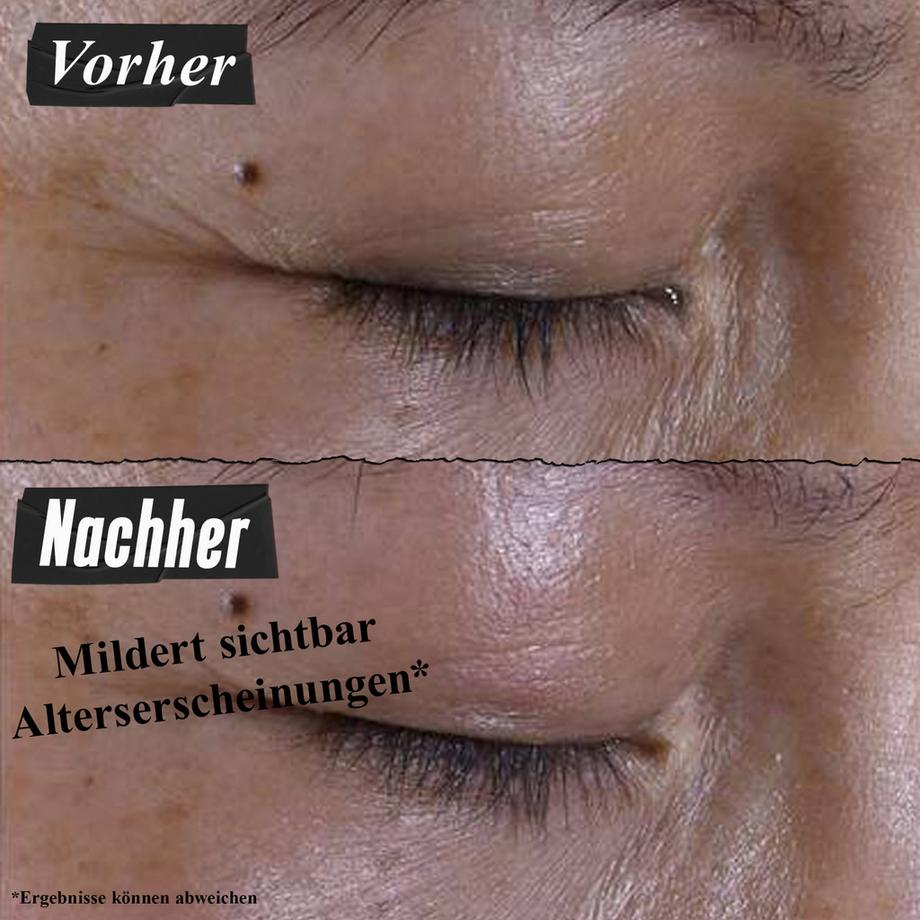 Kiehl's Super Multi-Corrective Eye Zone Treatment Crema per gli occhi 