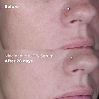 Skin republic  Niacinamide 10% + Zinc 1% Serum 