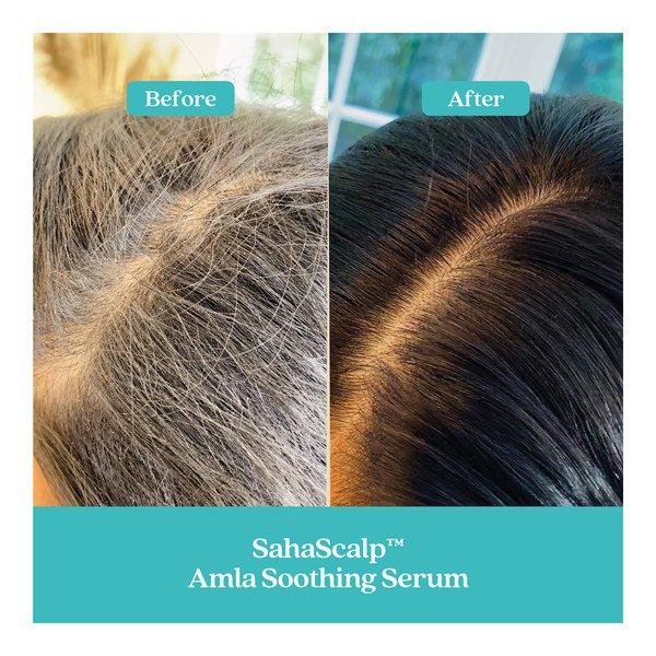 FABLE & MANE  SahaScalp™ - Beruhigendes Amla-Serum 