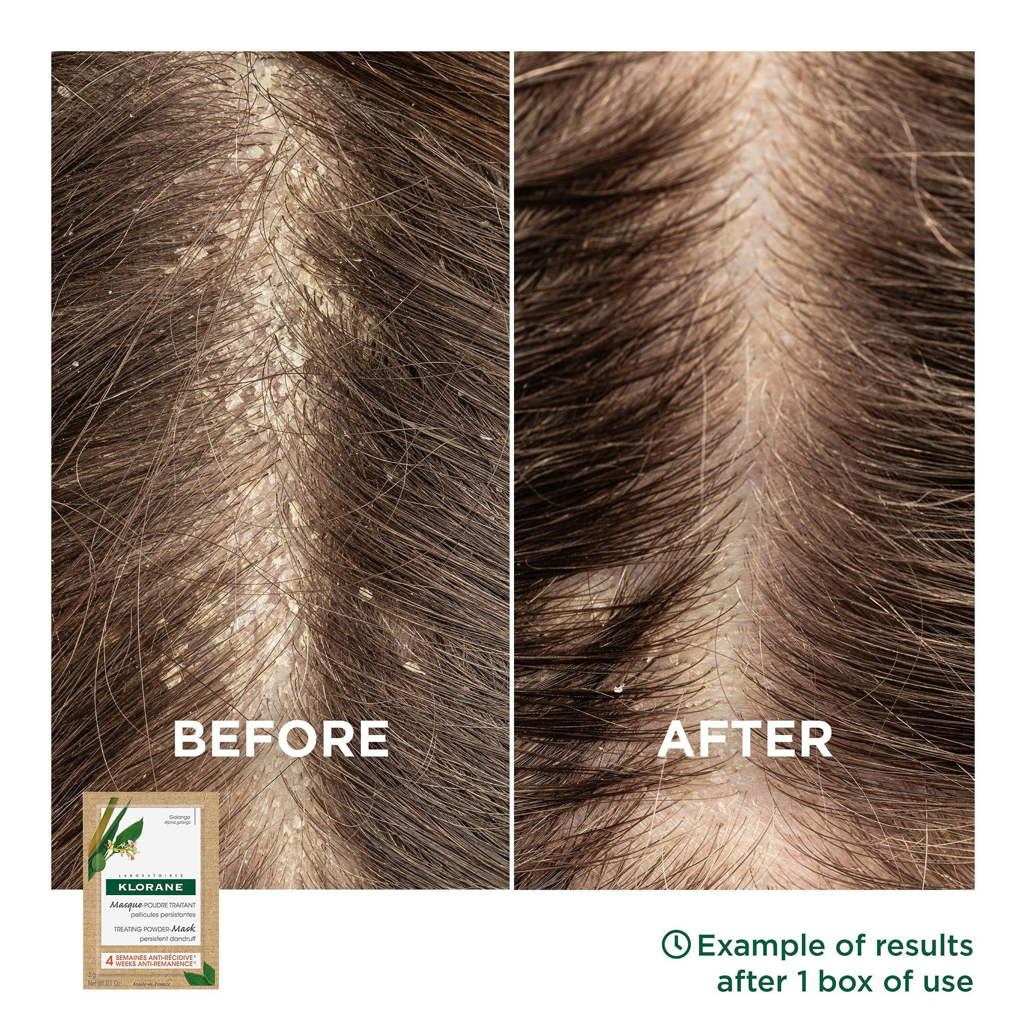 KLORANE Galanga Anti-Schuppen Masken-Pulver 