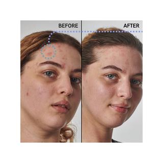 THE INKEY LIST  Lösung für trockene, raue Haut mit Urea 10 % - Gesichtsserum 