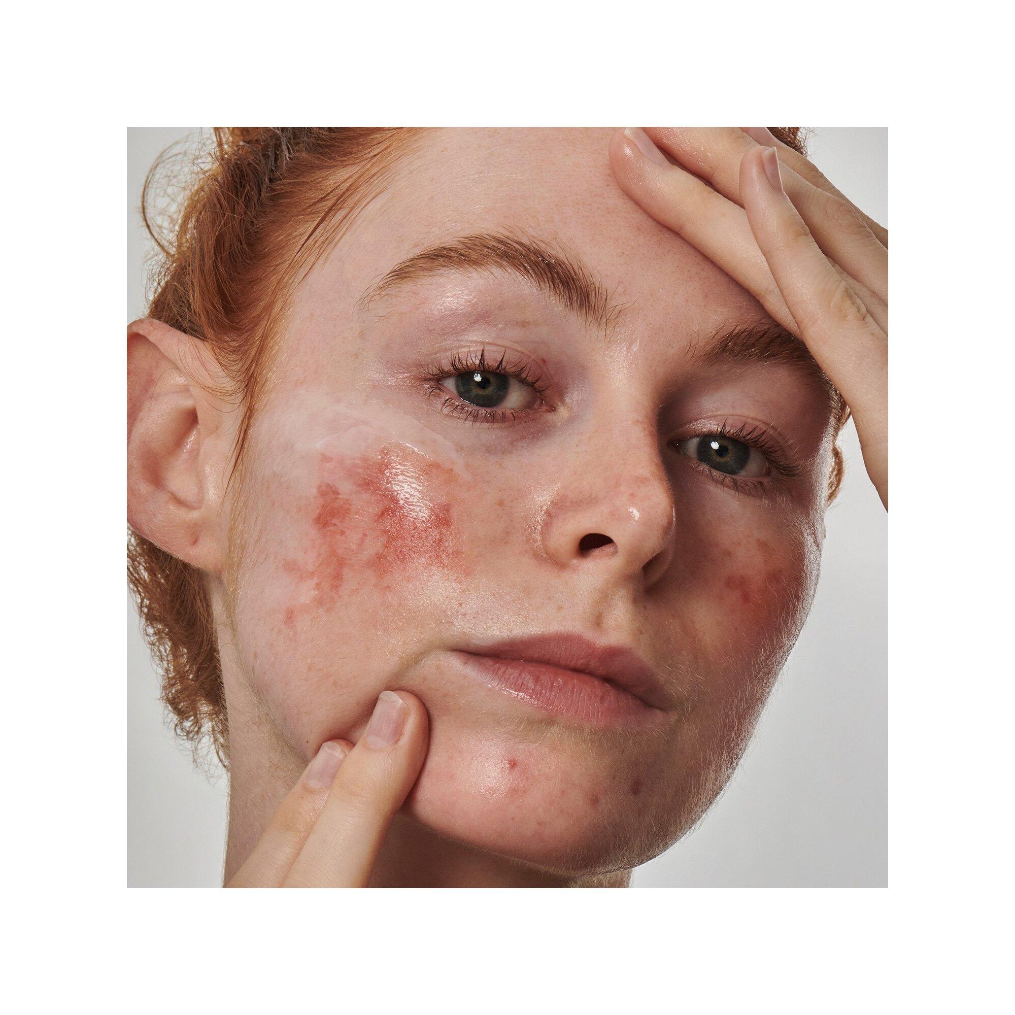 THE INKEY LIST  Solution Anti-rougeurs avec de l'acide azélaïque 10 % - Sérum visage 