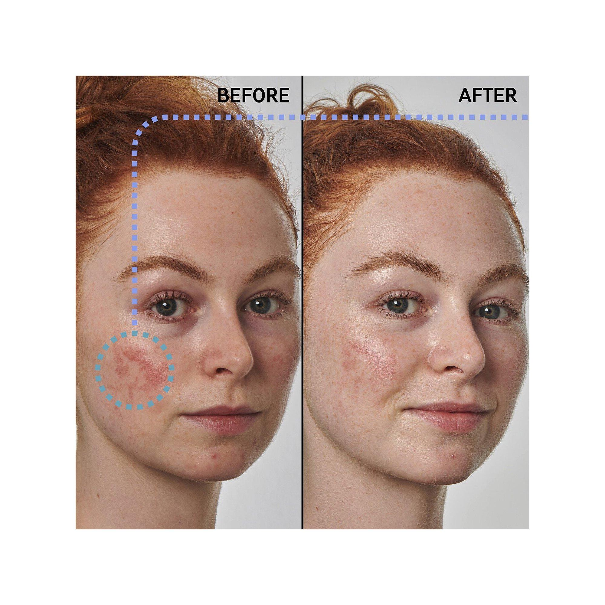 THE INKEY LIST  Anti-Rötungs-Lösung mit Azelainsäure 10 % - Gesichtsserum 