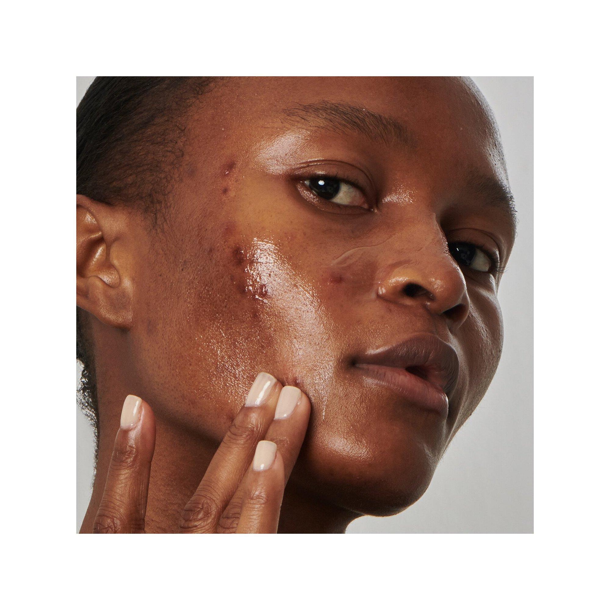 THE INKEY LIST  Lösung gegen überschüssigen Talg mit 20 % Niacinamid - Gesichtsserum 