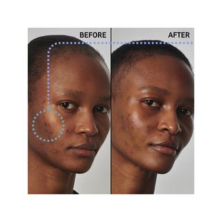 THE INKEY LIST  Solution contre l'excès de sébum avec du niacinamide 20 % - Sérum visage 