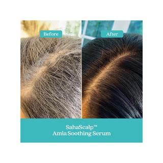 FABLE & MANE  Kit de Remise à Zero du Cuir Chevelu SahaScalp™ - Coffret soin cheveux 