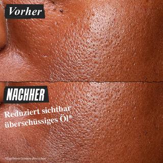 Kiehl's  Ultra Pure High-Potency Serum 5.0% Niacinamide 