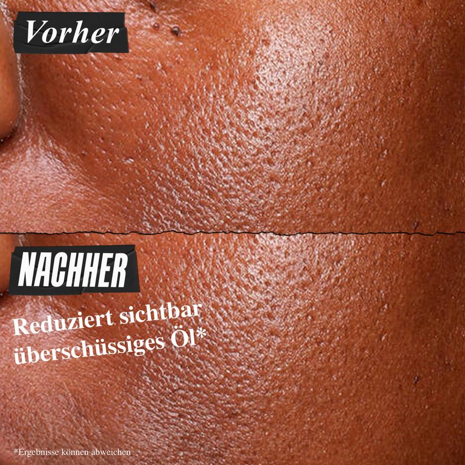 Kiehl's  Ultra Pure High-Potency Serum 5.0% Niacinamide 