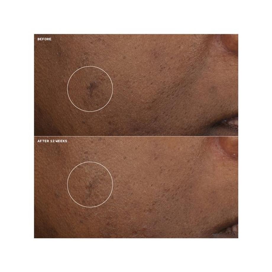 CLINIQUE Even better clinical Even Better Clinical Brightening Moisturizer 