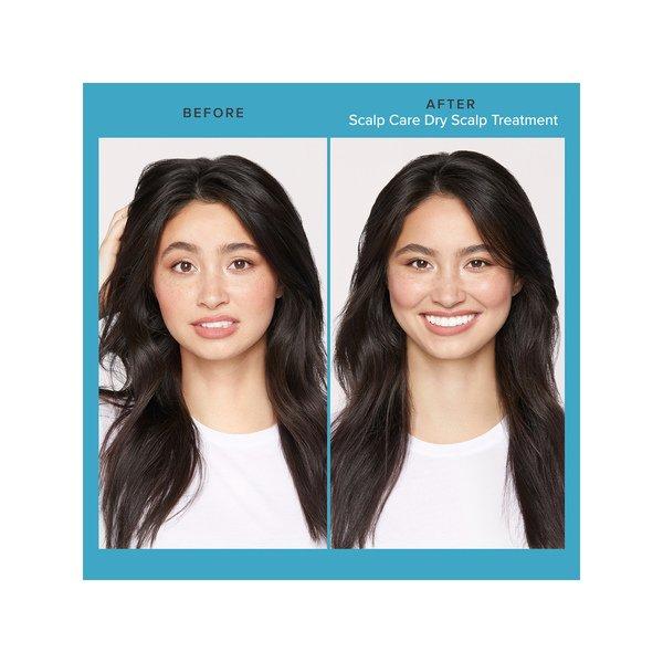 LIVING PROOF  Scalp Care Dry Scalp Treatment - Riequilibrante per il cuoio capelluto 
