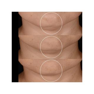 Lancôme Renergie Rénergie H.P.N. 300-Peptide Cream Refill 