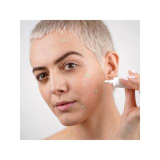 SEASONLY  SOS SPOT - Lokale Pflege gegen Unreinheiten 